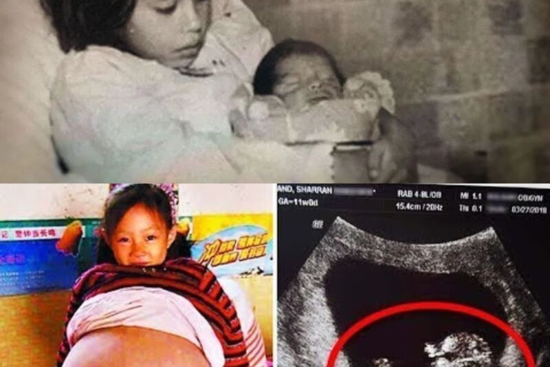 “Médicos acham que menina de 5 anos tem tumor… mas ela estava grávida!”