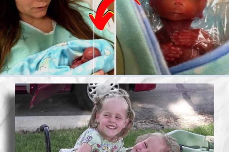10 dos bebês mais incomuns que nasceram diferentes