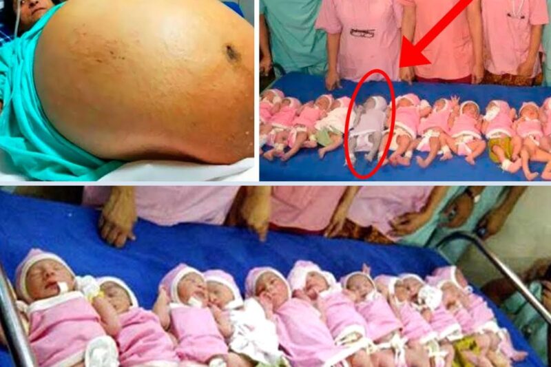 Uma mãe dá à luz 10 bebês, e os médicos percebem que um deles não é um bebê! Que choque!