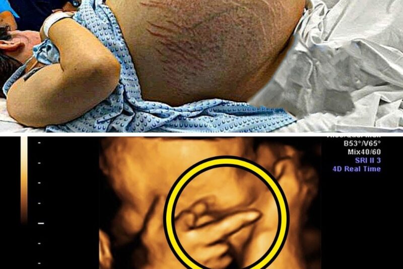 Mãe acha que está grávida de gêmeos, médico fica paralisado ao ver o ultrassom.