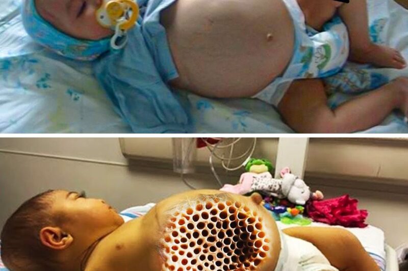 A barriga do bebê continua crescendo, o médico vê o ultrassom e pede para a mãe sair da sala.