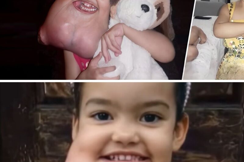 A bebê com o queixo mais comprido do mundo completou 10 anos, e veja como ela está agora!
