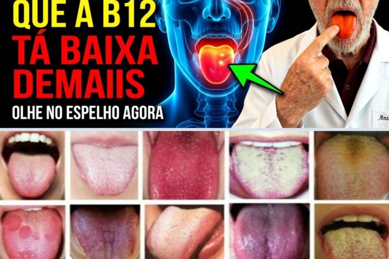 Sua LÍNGUA te avisa que a VITAMINA B12 está baixa demais (OLHE NO ESPELHO AGORA)