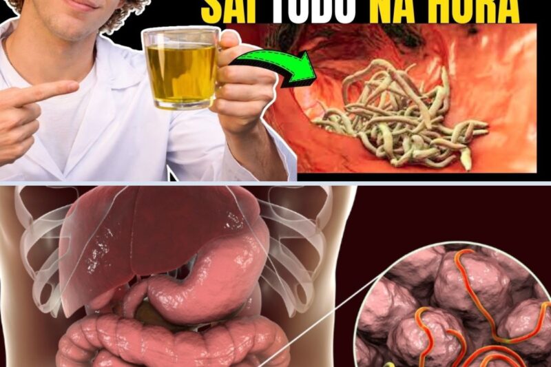 SAI TUDO PELAS FEZES! Veja os 7 Sinais e a Erva que EXPULSA VERMES e PARASITAS HOJE!